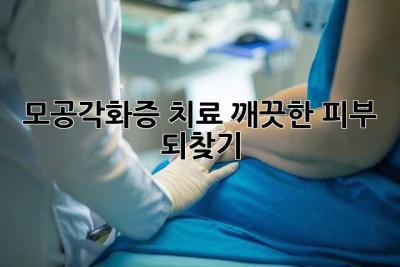 모공각화증 치료, 깨끗한 피부 되찾기
